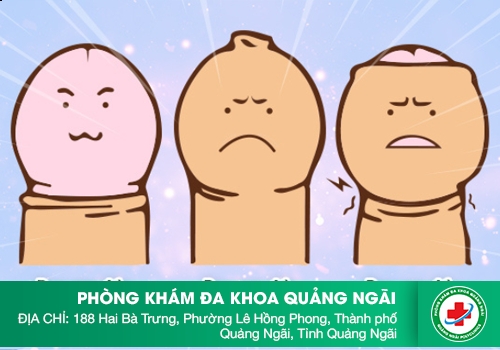 Bảng giá chi phí phẫu thuật cắt bao quy đầu ở Hà Nội hết bao nhiêu
